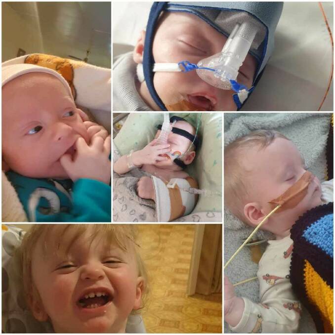Little P.J. is pictured numerous times in a collage, some images showing him in hospital for his laryngomalacia. Pictures upplied